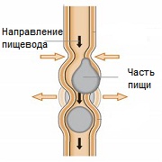 Острая кишечная непроходимость
